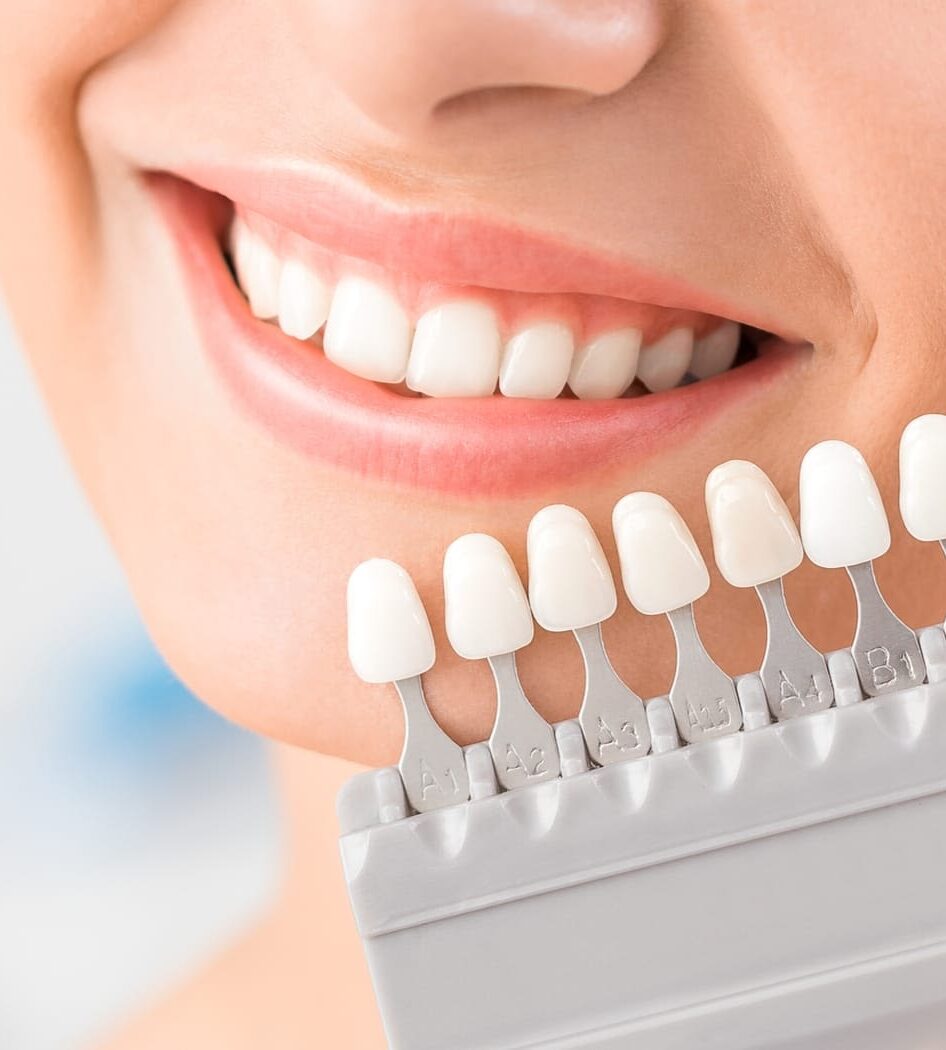 Same-Day Crowns in Gilbert AZ